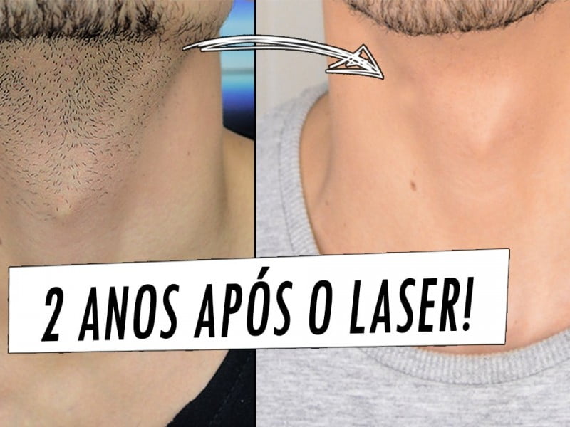 Depila O Virilha Masculina Antes E Depois Not Cias E Entretenimento