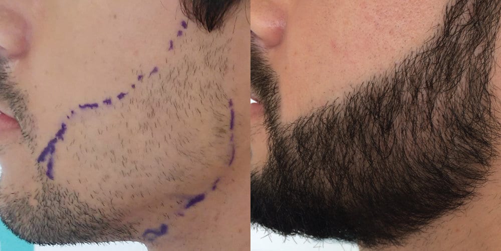 Estilos de Barba para se Inspirar 