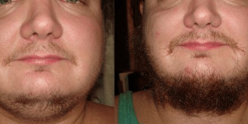 crescimento de barba