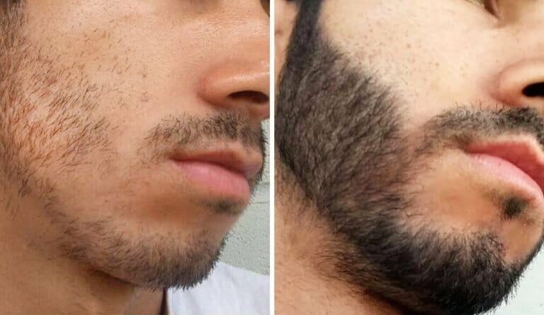 crescimento de barba